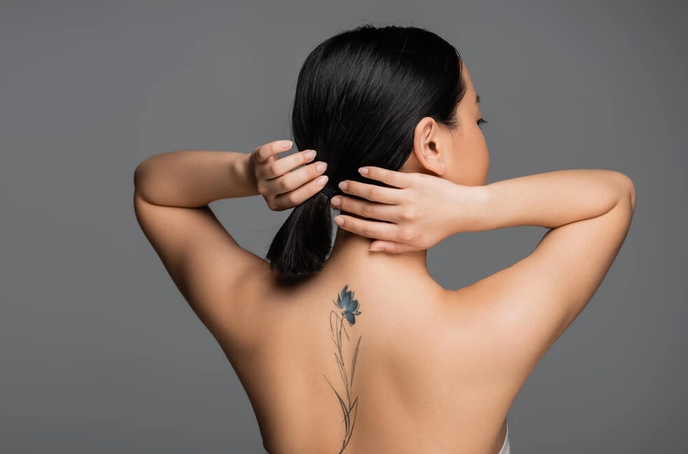 Comparing Tattoo Removal Technologies in Seattle