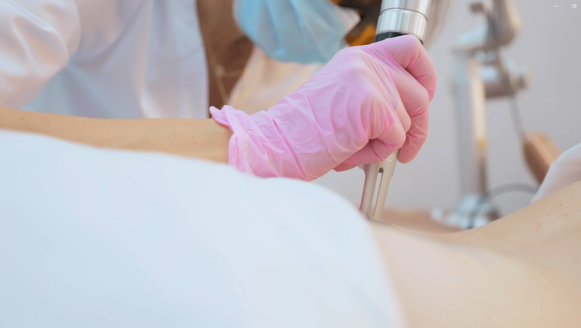 Factors Affecting Tattoo Removal