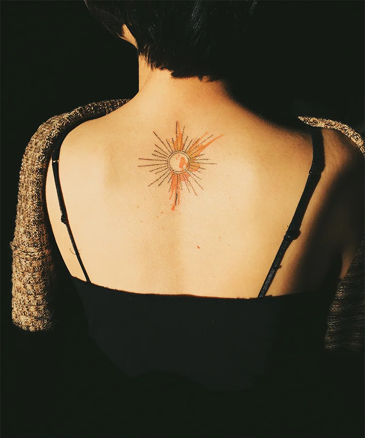 Evolution of Tattoo Removal Technology